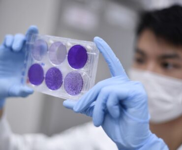 Científicos peruanos investigan si suplementos dietéticos previenen covid-19